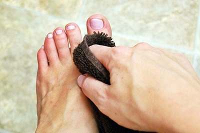 Medical Treatment for Athlete's Foot