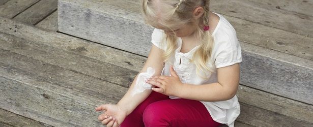 Natural Remedies for a Fungal Skin Infection in a Child